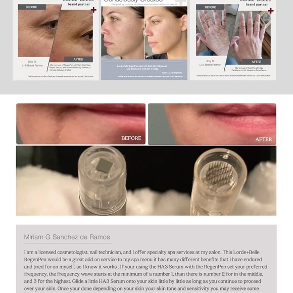 Viral LORDE + BELLE RegenPen- take skincare to a new level!🤩 - Picture 5 of 7